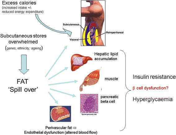 What Is Frank Diabetes? Understanding This Rare and Misunderstood Condition