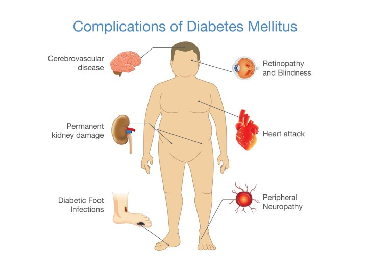 Individuals Who Have Untreated Diabetes Are Likely to Experience Serious Health Complications